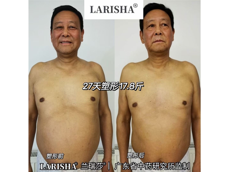 兰瑞莎减肥反馈